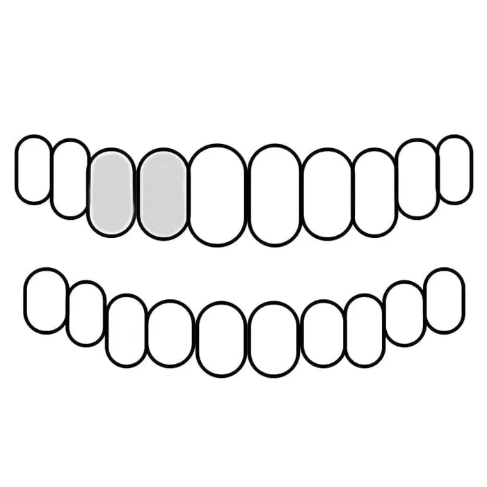 925 Sterling Silver Double Cap Heart Cutout Open Tooth Custom Grillz Bling Cartel Admin Rings