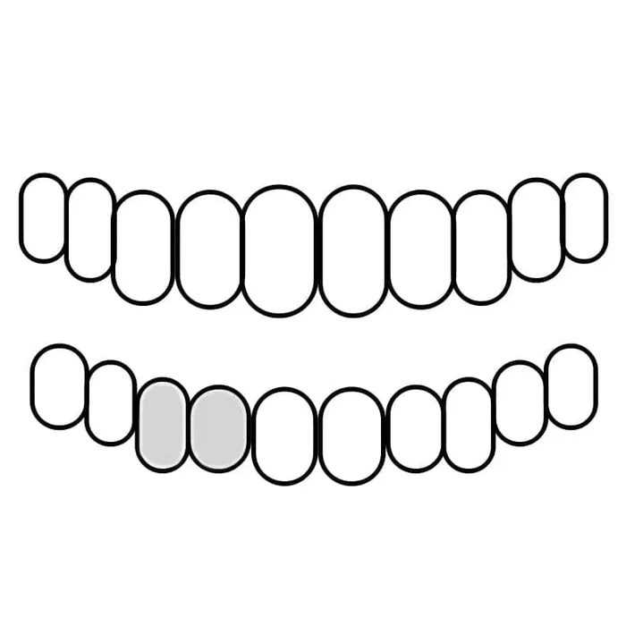 925 Sterling Silver Double Cap Heart Cutout Open Tooth Custom Grillz Bling Cartel Admin Rings