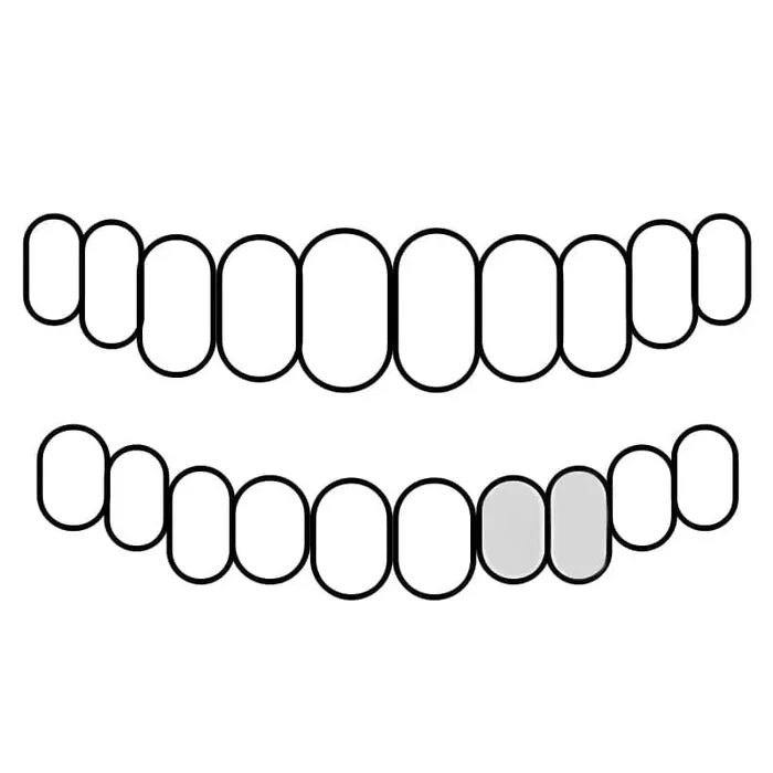 925 Sterling Silver Double Cap Heart Cutout Open Tooth Custom Grillz Bling Cartel Admin Rings