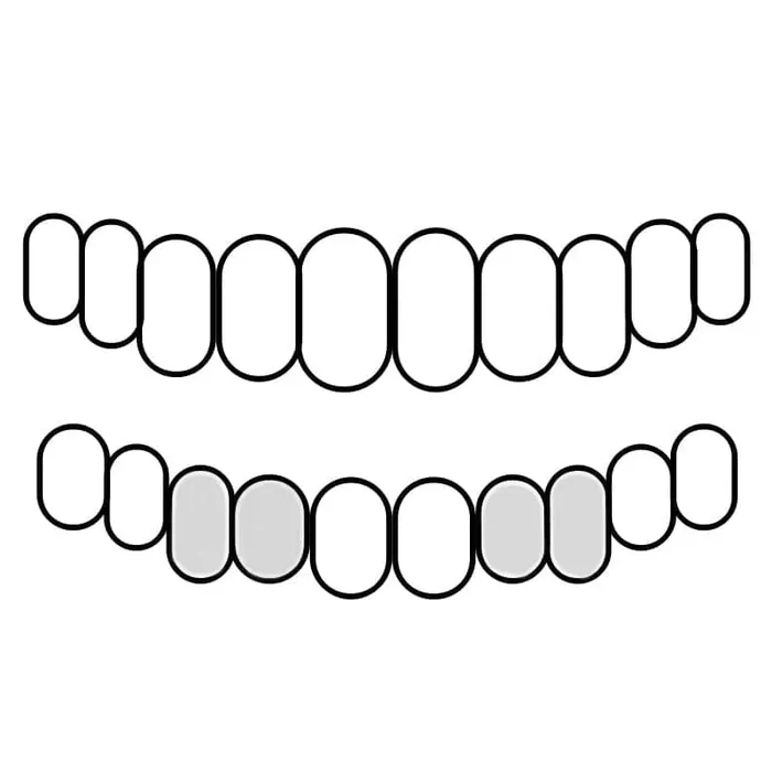 925 Sterling Silver Double Cap Heart Cutout Open Tooth Custom Grillz Bling Cartel Admin Rings